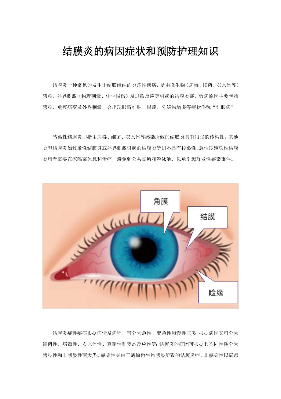 结膜炎的病因症状和预防护理知识_第1页