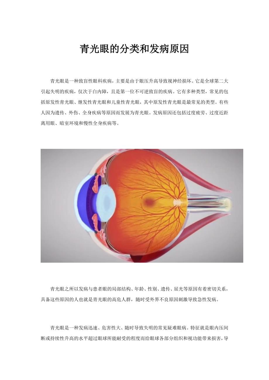 青光眼的分类和发病原因_第1页