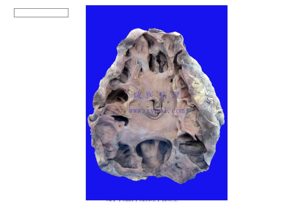 病理学大体标本图片_第1页
