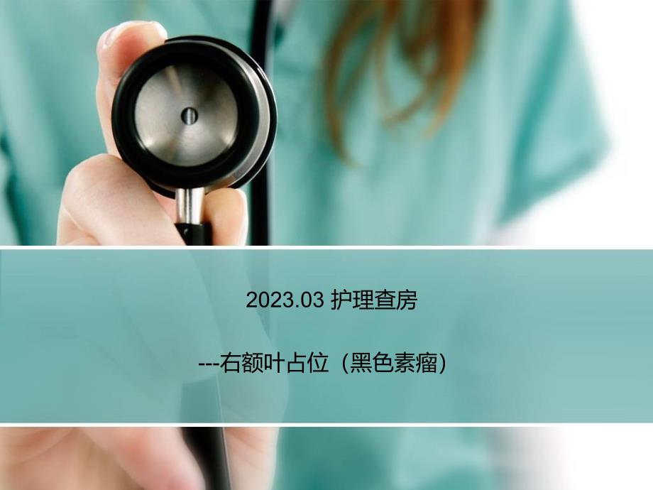 黑色素瘤的医疗护理查房_第1页