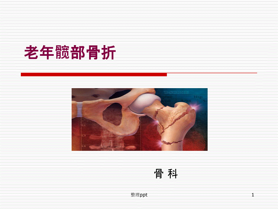 老年髋部骨折课件_第1页